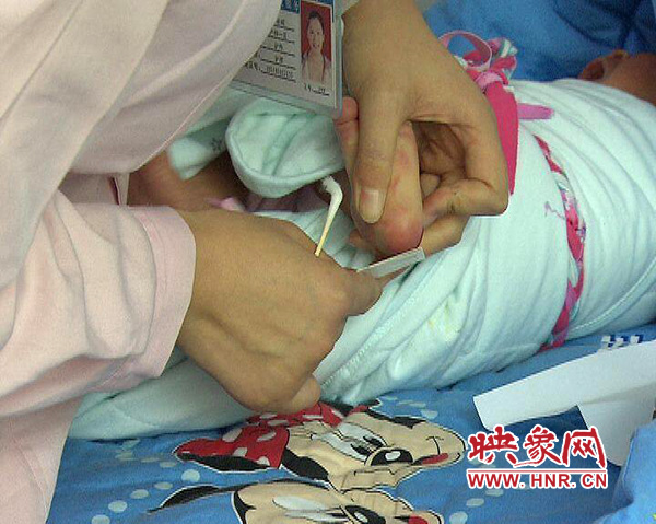 医护人员在为一名新出生婴儿采足跟血，做疾病筛查