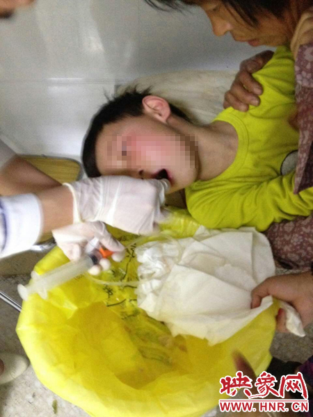 食物中毒三天死了 www.hnr.cn