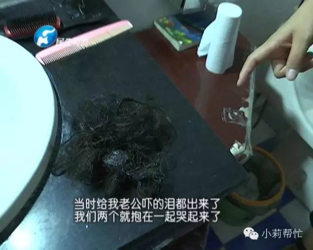 爱美的她竟然成了秃子！这样的事你也做过，看你以后还敢不敢再…