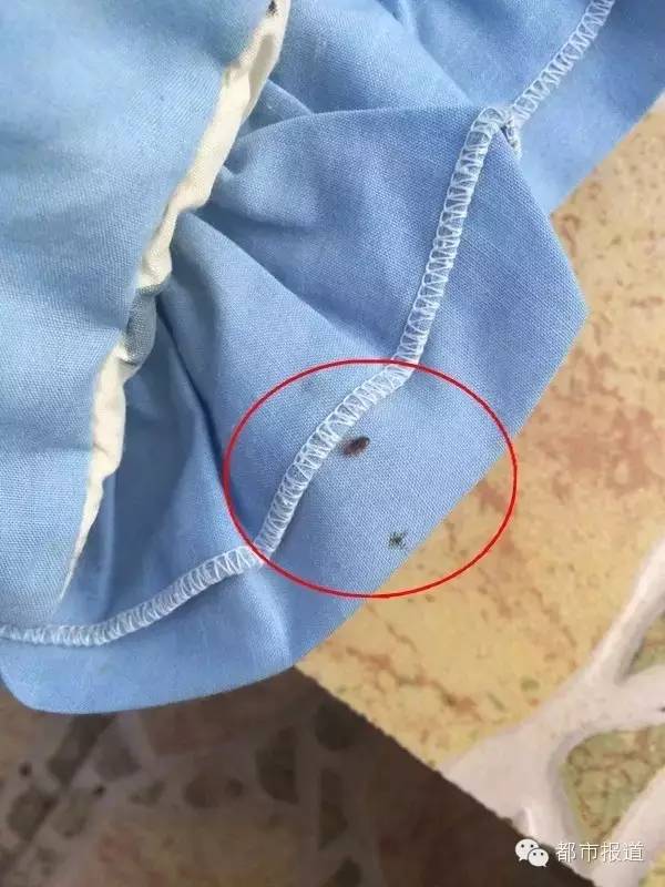 旅游回来没做这件事，全家人竟染上了“皮肤病”！