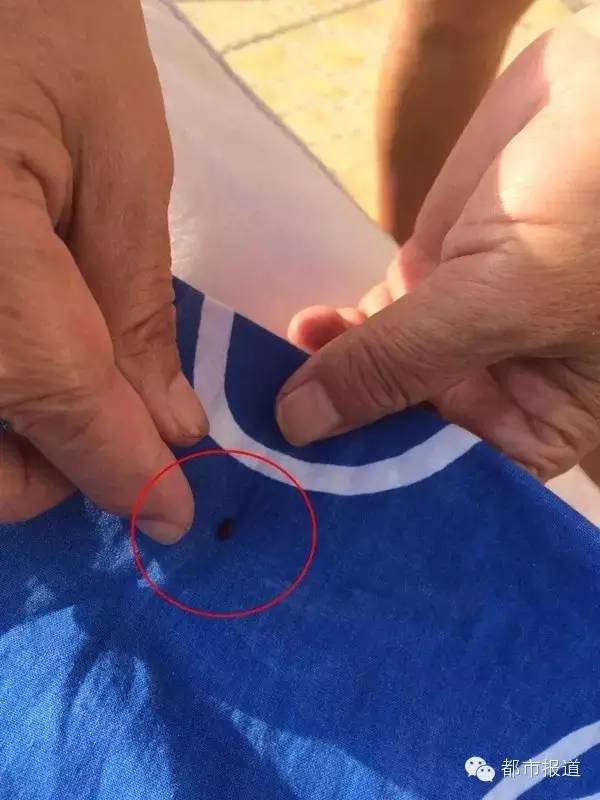 旅游回来没做这件事，全家人竟染上了“皮肤病”！