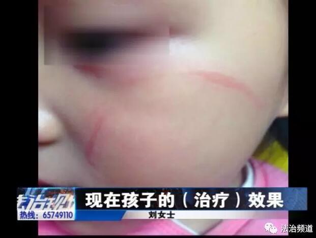 平顶山3岁女童上幼儿园 入园7天突然发生意外