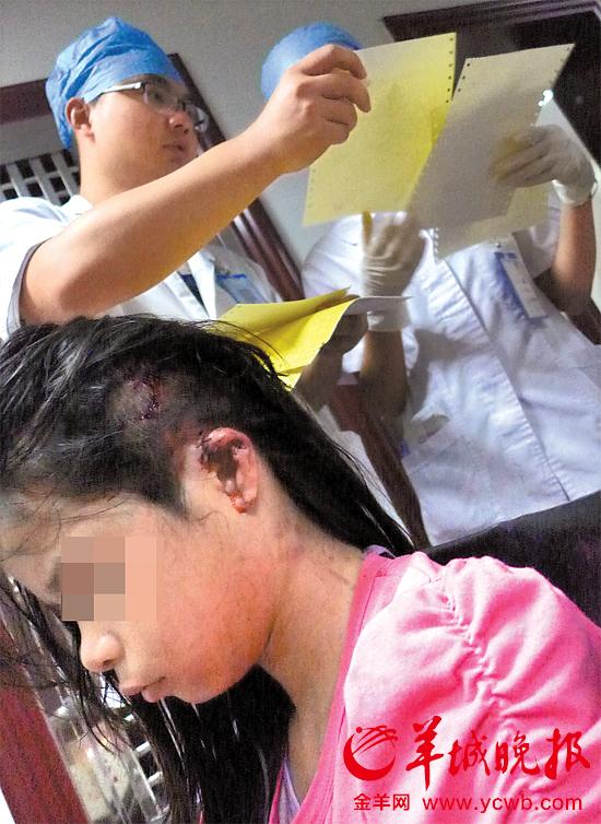受伤的11岁女孩头发被卷入扶梯，耳朵被严重拉伤，需手术。