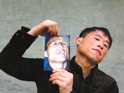 出狱后，贾相军第一时间拍了张照片，记录其门牙缺失的状态。记者 李显峰 摄