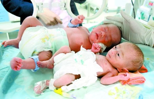 双胞胎婴儿共用胎盘:哥哥重4斤弟弟仅700克(图)