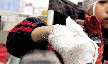 郑州6岁男童遭陌生男子砍6刀 伤口深至骨髓
