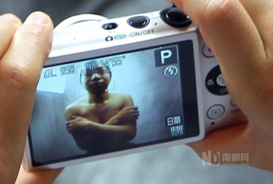 25岁男子只喜欢同性 广州做变性手术