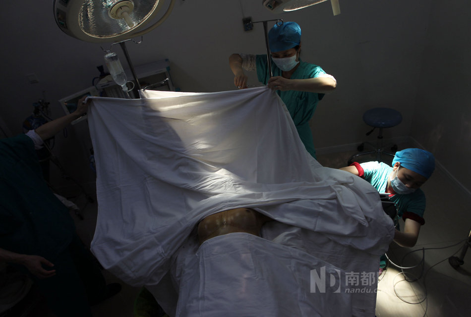 25岁男子只喜欢同性 广州做变性手术