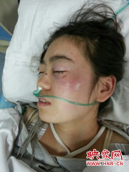 9月10日晚,被暴打的小陈出现了间歇性昏迷,被送进了省人民医院。