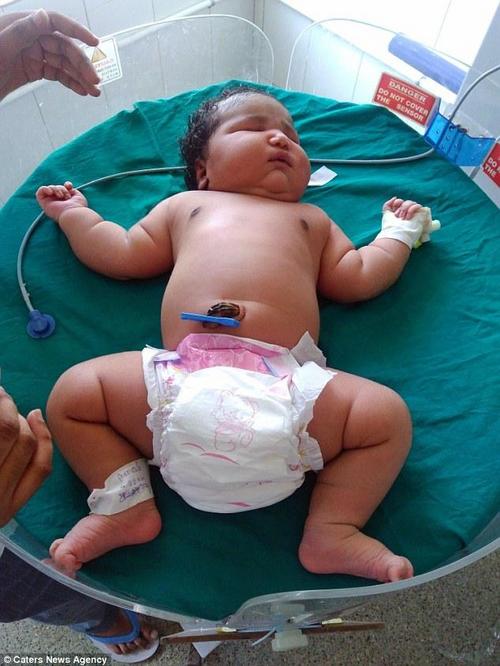  印度19岁女孩诞下世界最重女婴 出生重13.6斤