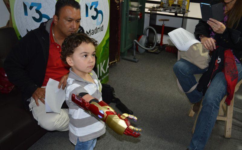 3岁残疾男童装上“钢铁右臂” 变铁臂阿童木