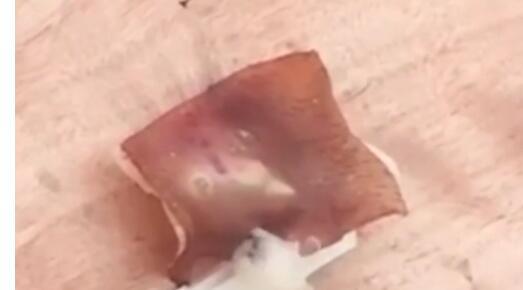 作为效应物的猪皮在照射下冒出浓烟