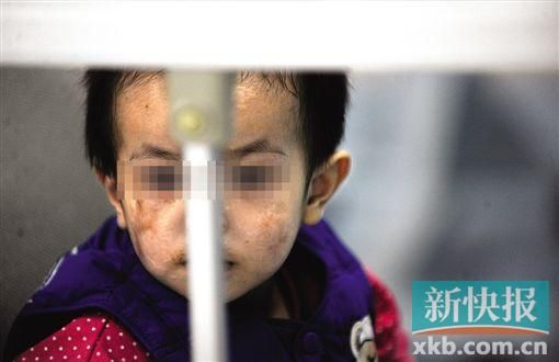 去年3月就能出院的小华(化名),目前还在广州市妇儿医疗中心的PICU里住着。新快报记者 孙毅/摄