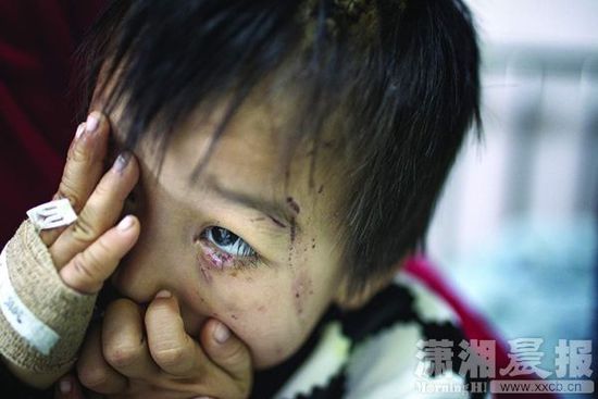 1月13日，湖南省儿童医院，4岁的源源用手蒙住了眼睛。