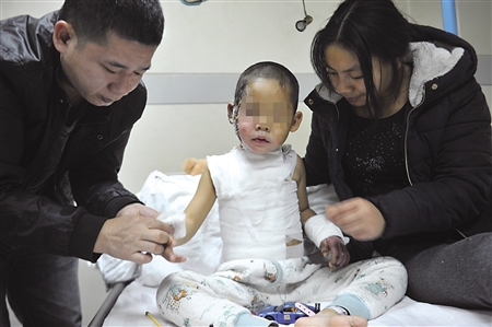 被烫伤的五岁孩子在医院接受治疗，父母在一旁照顾