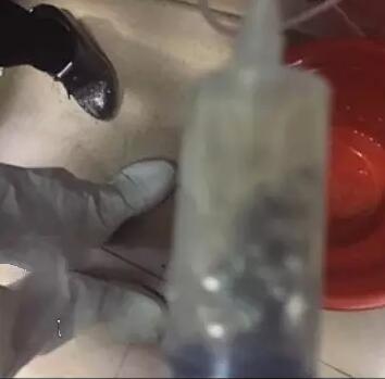 10岁男童被高年级女生逼吃铅笔芯 胃液都变成黑色