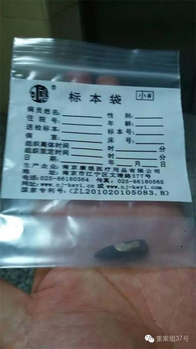 经警方鉴定，秦女士体内取出的子弹系56式步枪射出 。 受访者供图