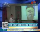 19小时 12名医生 河北男子完成全球第一例自体换脸手术