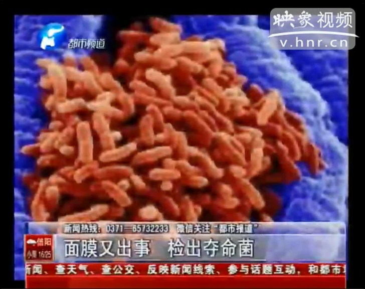 面膜又出事 检出夺命菌