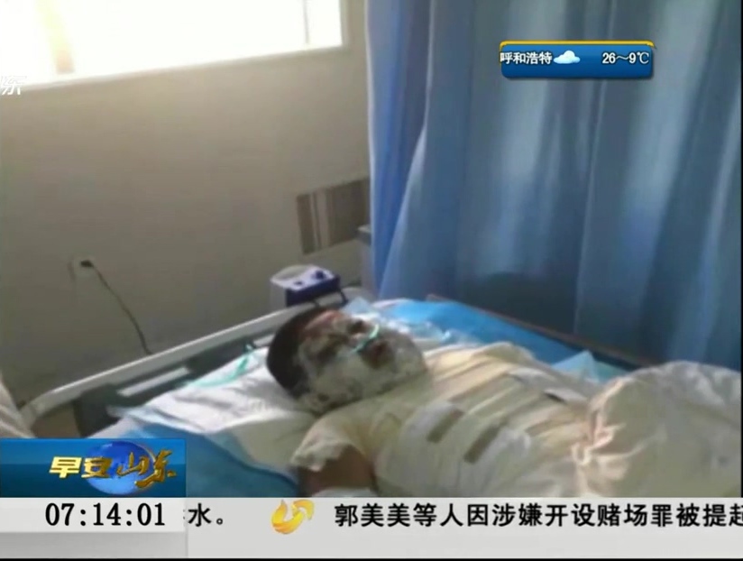 9岁男孩被汽油烧身 凶手竟是前舅妈