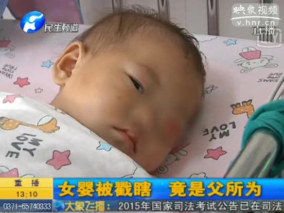 女婴被父亲用筷子戳瞎眼