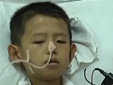 高压喷泉伤人 8岁男孩直肠被击穿