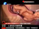 中国剖腹产率超高成隐忧