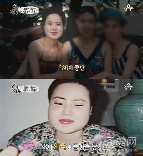 美女整容变“电风扇大妈” 盘点整容失败惊悚案例