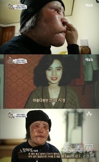 美女整容变“电风扇大妈” 盘点整容失败惊悚案例