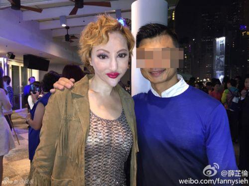 美女整容变“电风扇大妈” 盘点整容失败惊悚案例