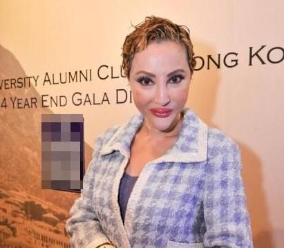 美女整容变“电风扇大妈” 盘点整容失败惊悚案例