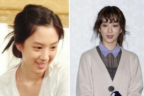美女整容变“电风扇大妈” 盘点整容失败惊悚案例