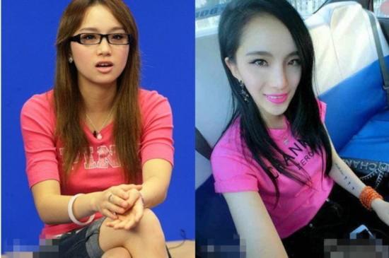 美女整容变“电风扇大妈” 盘点整容失败惊悚案例